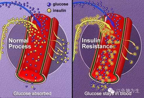 Ⅱ型糖尿病的發(fā)病機理 Ⅱ型糖尿病的發(fā)病機理